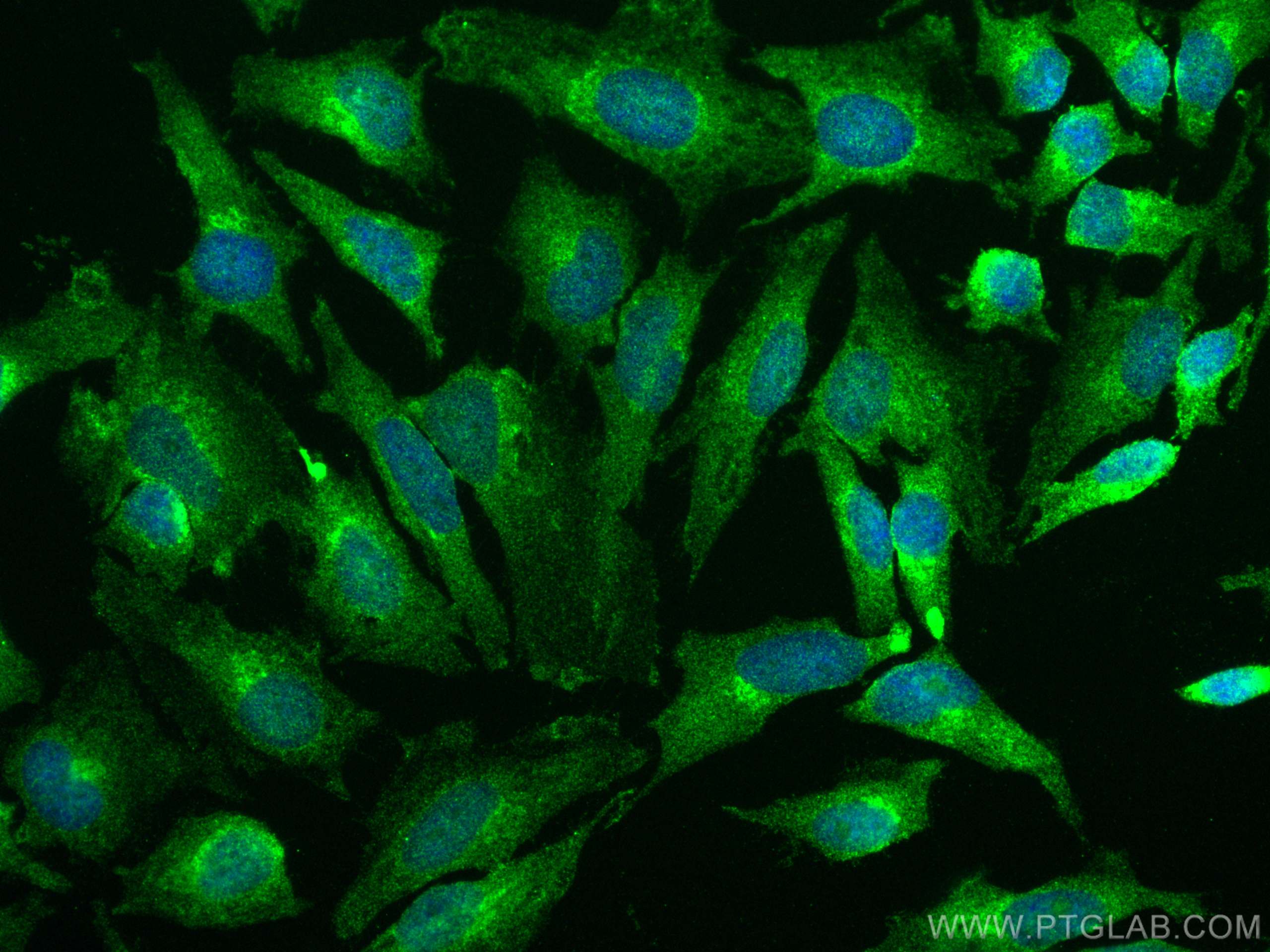Immunofluorescence (IF) / fluorescent staining of HeLa cells using TIP47 Monoclonal antibody (66523-1-Ig)