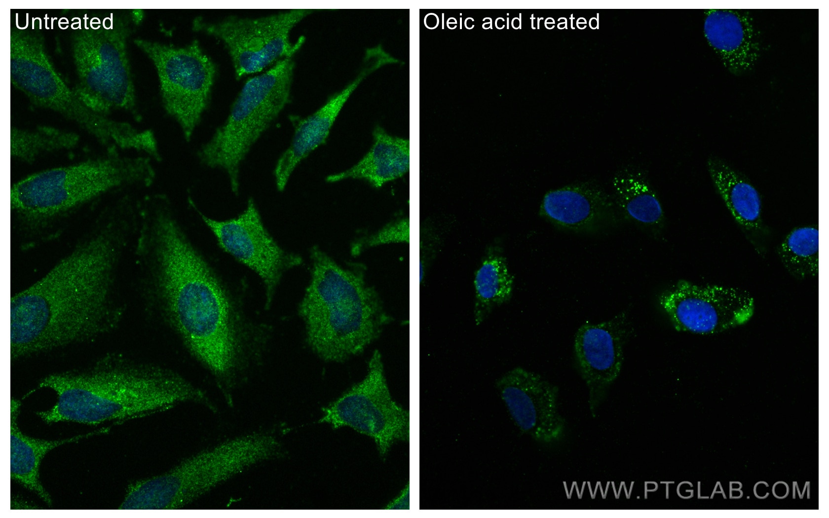 Immunofluorescence (IF) / fluorescent staining of HeLa cells using TIP47 Monoclonal antibody (66523-1-Ig)