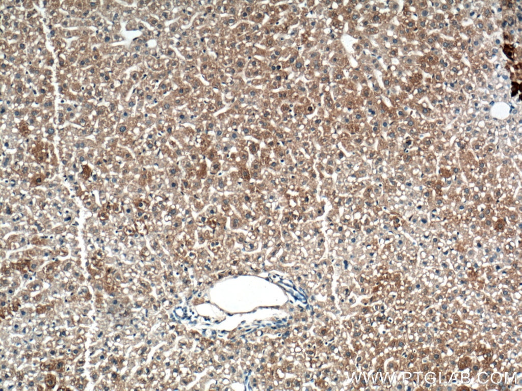 Immunohistochemistry (IHC) staining of mouse liver tissue using TIP47 Monoclonal antibody (66523-1-Ig)