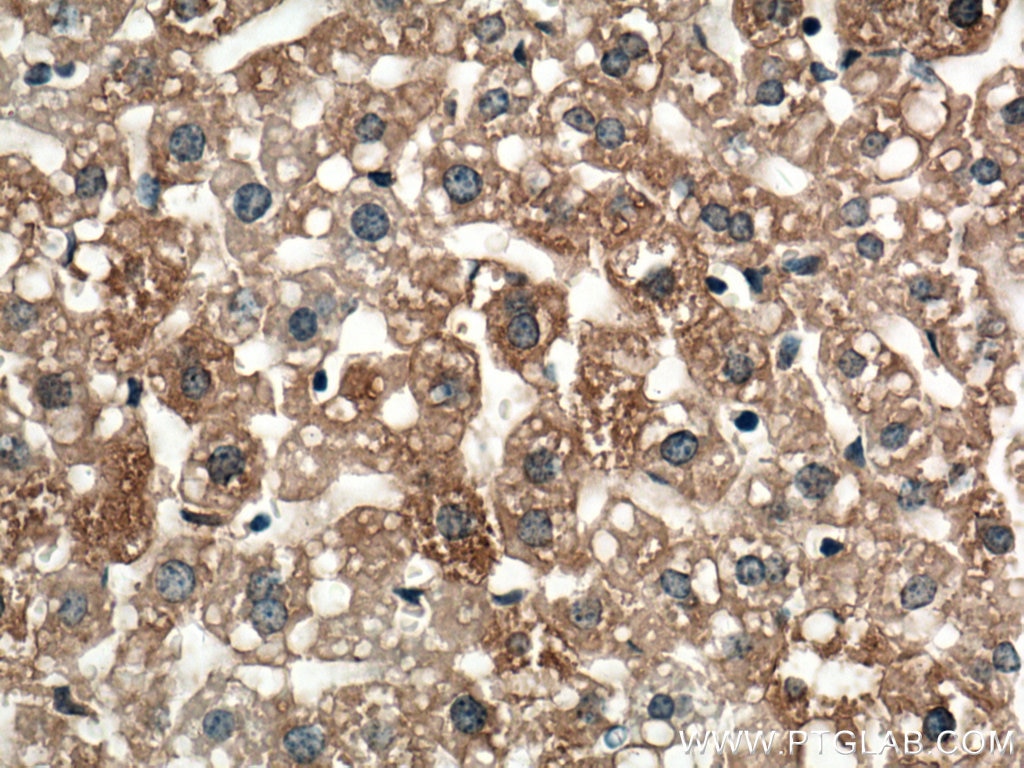 Immunohistochemistry (IHC) staining of mouse liver tissue using TIP47 Monoclonal antibody (66523-1-Ig)
