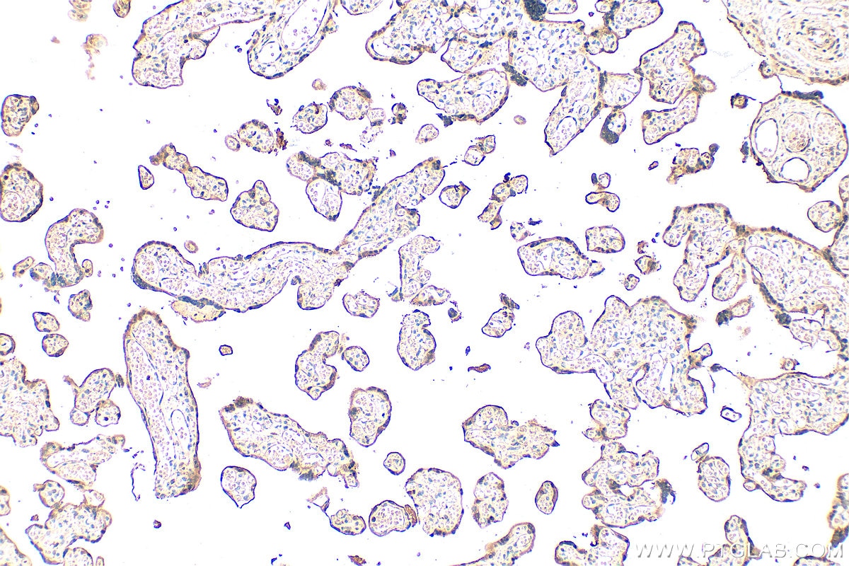 Immunohistochemistry (IHC) staining of human placenta tissue using Perilipin 3/TIP47 Monoclonal antibody (66523-1-Ig)