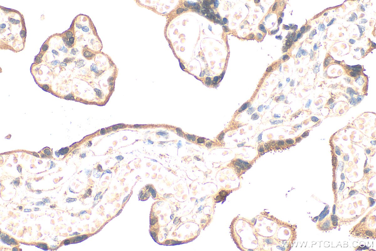 Immunohistochemistry (IHC) staining of human placenta tissue using Perilipin 3/TIP47 Monoclonal antibody (66523-1-Ig)