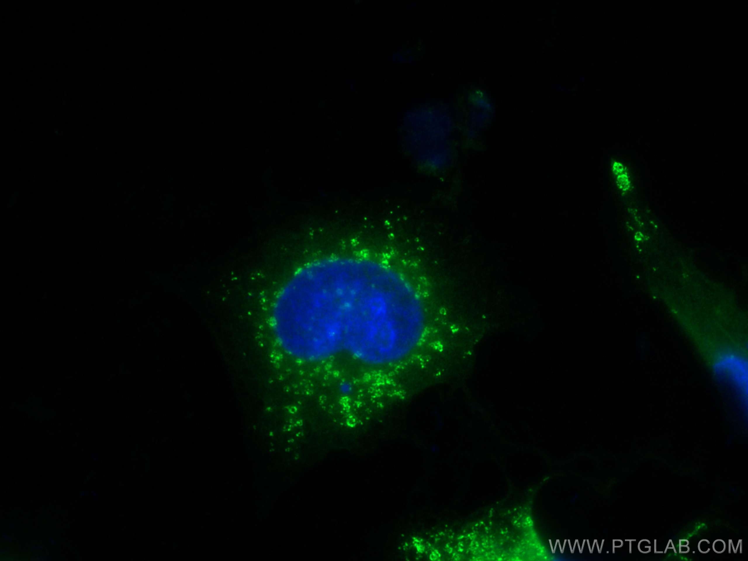 Immunofluorescence (IF) / fluorescent staining of HUVEC cells using CoraLite® Plus 488-conjugated TIP47 Polyclonal ant (CL488-10694)