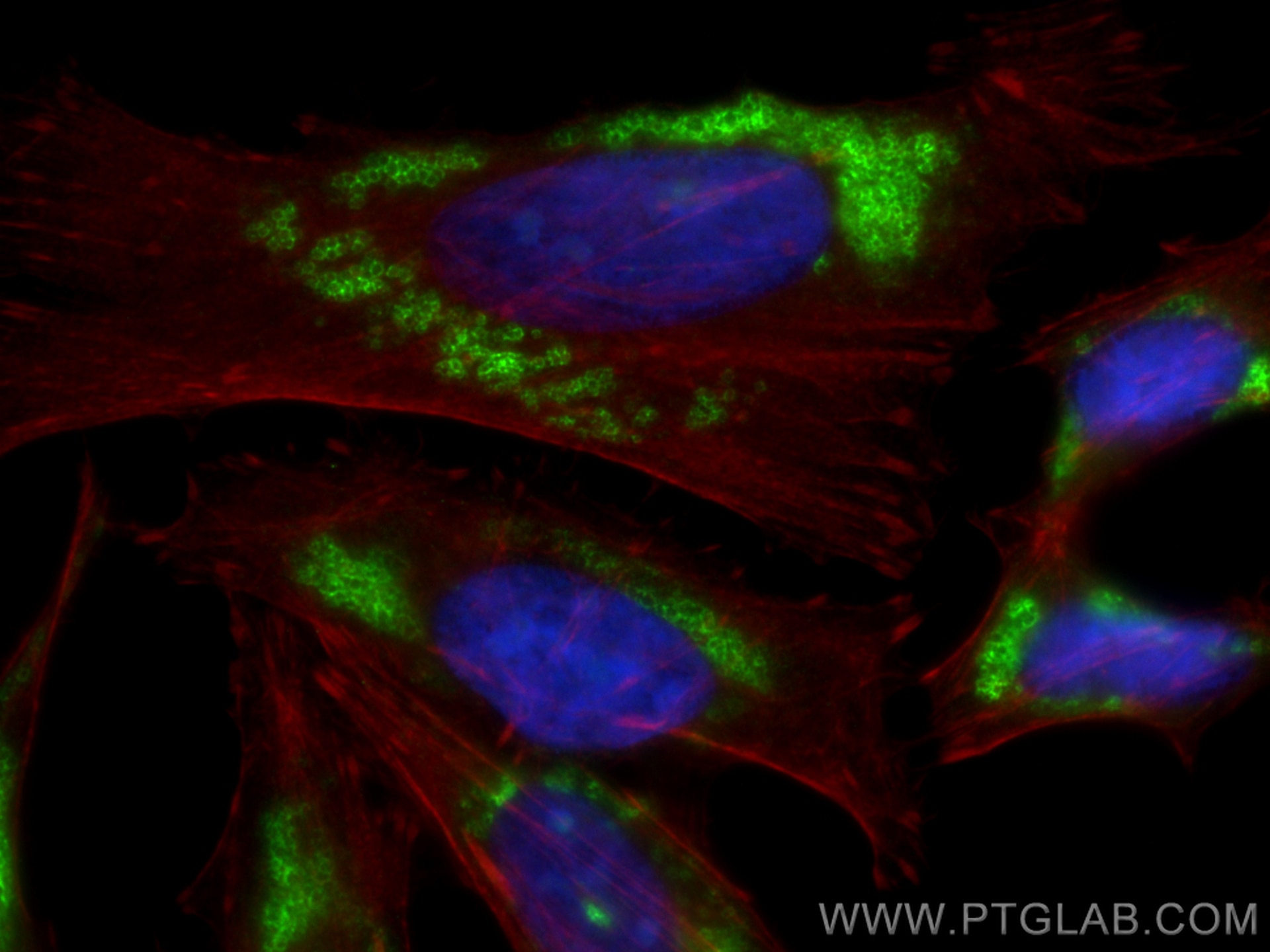 Immunofluorescence (IF) / fluorescent staining of HeLa cells using CoraLite® Plus 488-conjugated TIP47 Polyclonal ant (CL488-10694)