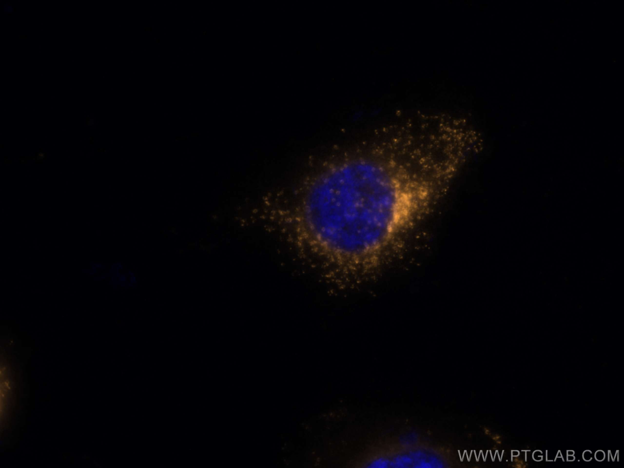 IF Staining of HUVEC using CL555-10694