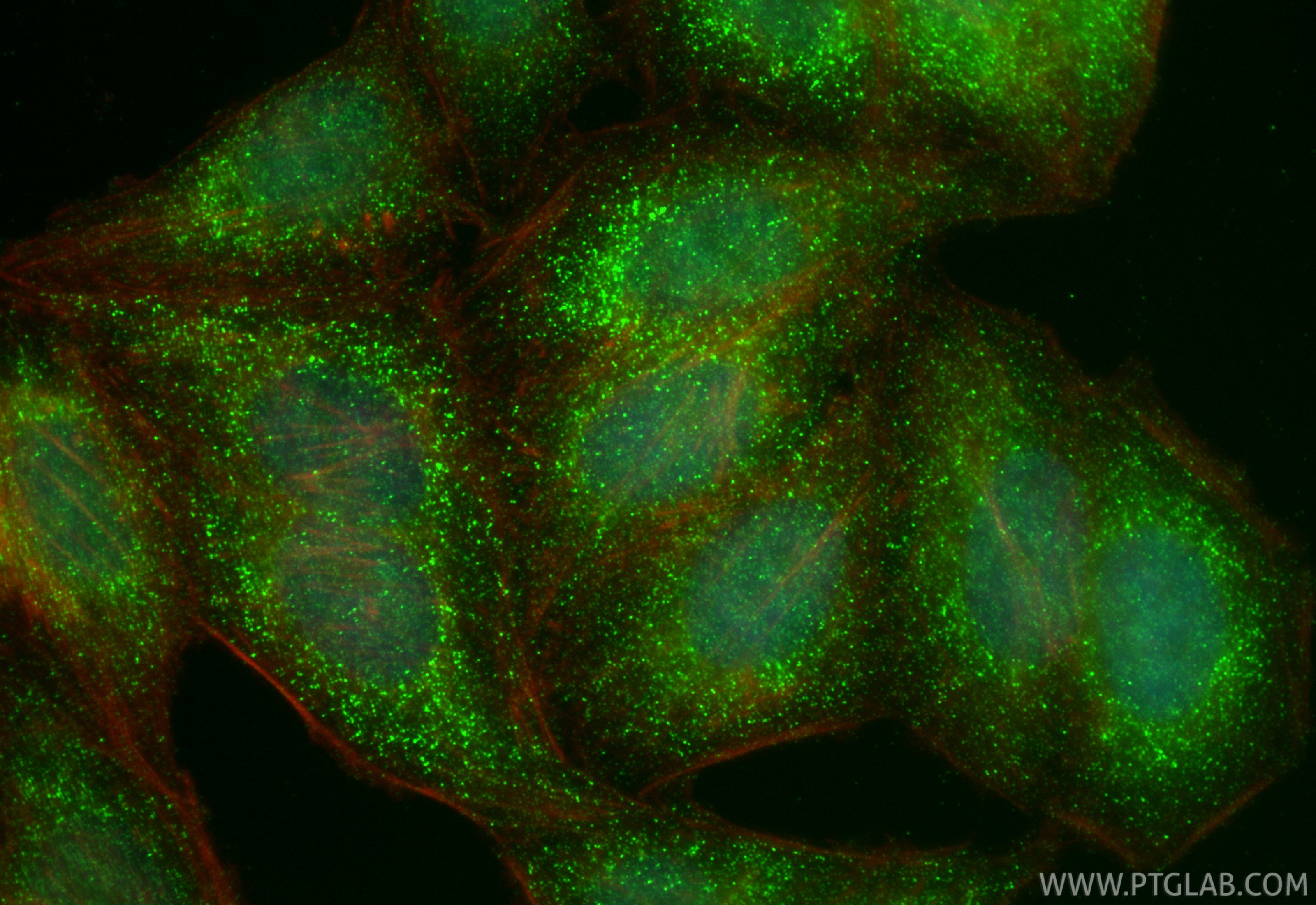 IF Staining of HepG2 using RMX00083 Immunofluorescence (IF) / fluorescent staining of HepG2 cells using Multi-rAb® TIPE2/TNFAIP8L2 Multi-Recombinant antib (RMX00083)