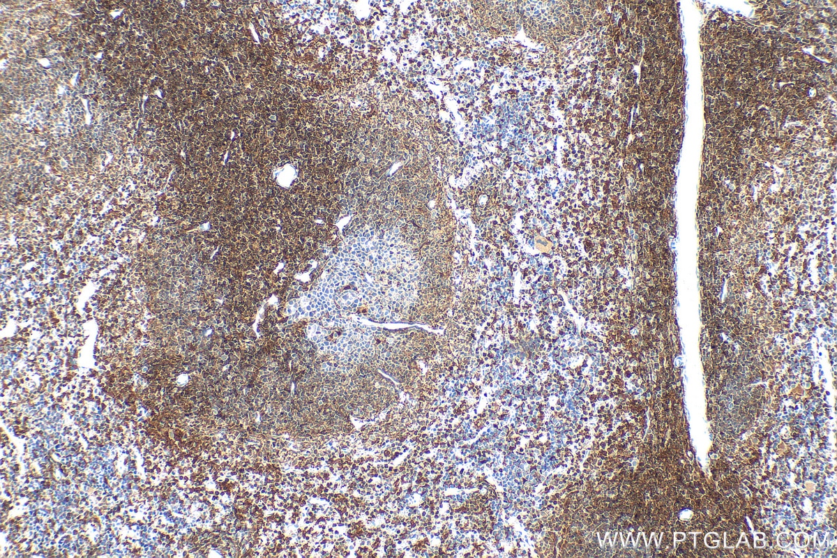 IHC staining of mouse spleen using RMX00083 Immunohistochemistry (IHC) staining of mouse spleen tissue using Multi-rAb® TIPE2/TNFAIP8L2 Multi-Recombinant antib (RMX00083)