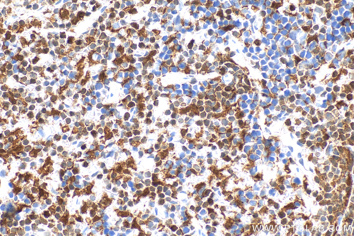 IHC staining of mouse spleen using RMX00083 Immunohistochemistry (IHC) staining of mouse spleen tissue using Multi-rAb® TIPE2/TNFAIP8L2 Multi-Recombinant antib (RMX00083)