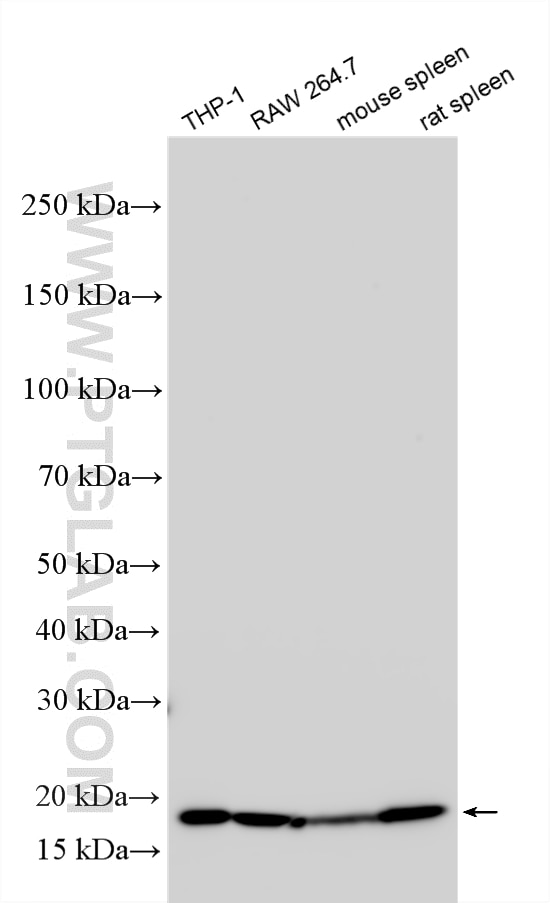 WB analysis using RMX00083 Western Blot (WB) analysis of various lysates using Multi-rAb® TIPE2/TNFAIP8L2 Multi-Recombinant antib (RMX00083)