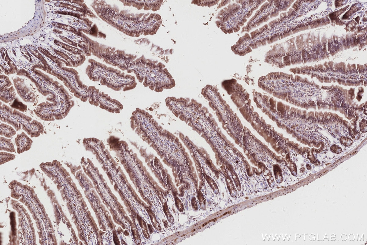 Immunohistochemistry (IHC) staining of mouse small intestine tissue using TIPIN Polyclonal antibody (11972-2-AP)