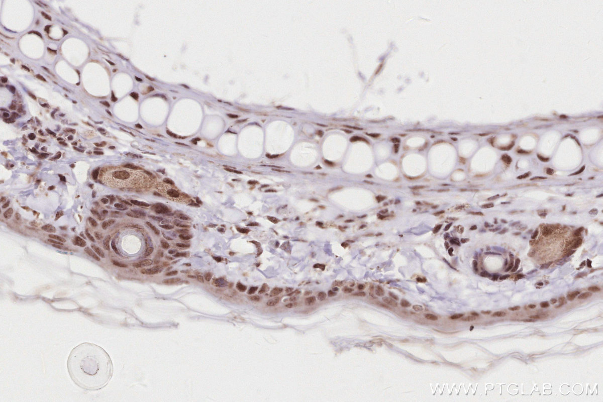 Immunohistochemistry (IHC) staining of rat skin tissue using TIPIN Polyclonal antibody (11972-2-AP)
