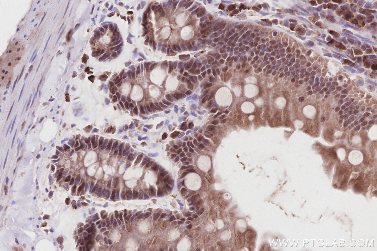 Immunohistochemistry (IHC) staining of rat small intestine tissue using TIPIN Polyclonal antibody (11972-2-AP)