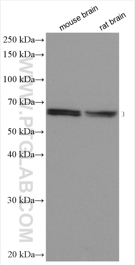Western Blot (WB) analysis of various lysates using TIPIN Polyclonal antibody (11972-2-AP)