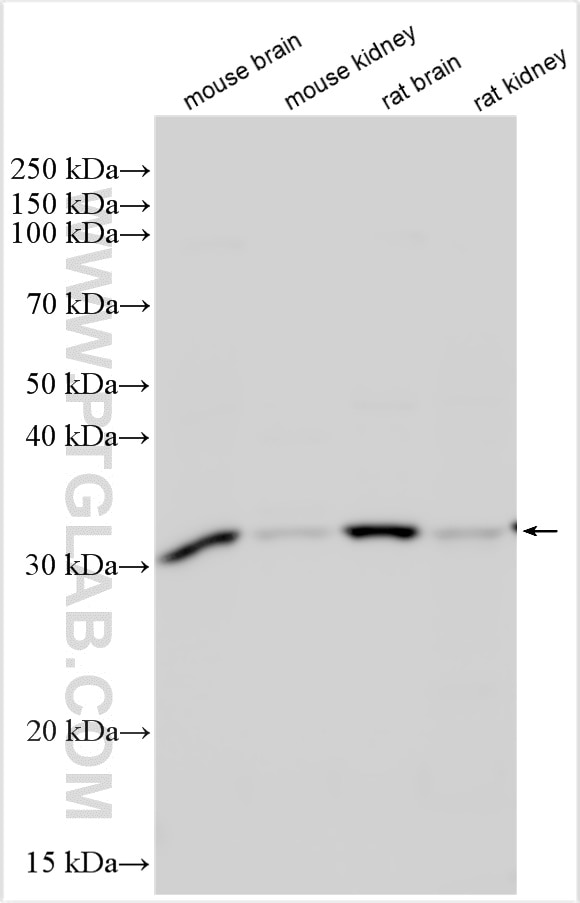 Western Blot (WB) analysis of various lysates using TIPRL Polyclonal antibody (15933-1-AP)