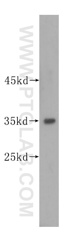 Western Blot (WB) analysis of Jurkat cells using TIRAP Polyclonal antibody (10497-1-AP)