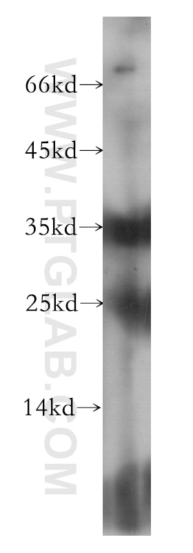 Western Blot (WB) analysis of human heart tissue using TIRAP Monoclonal antibody (60016-1-Ig)