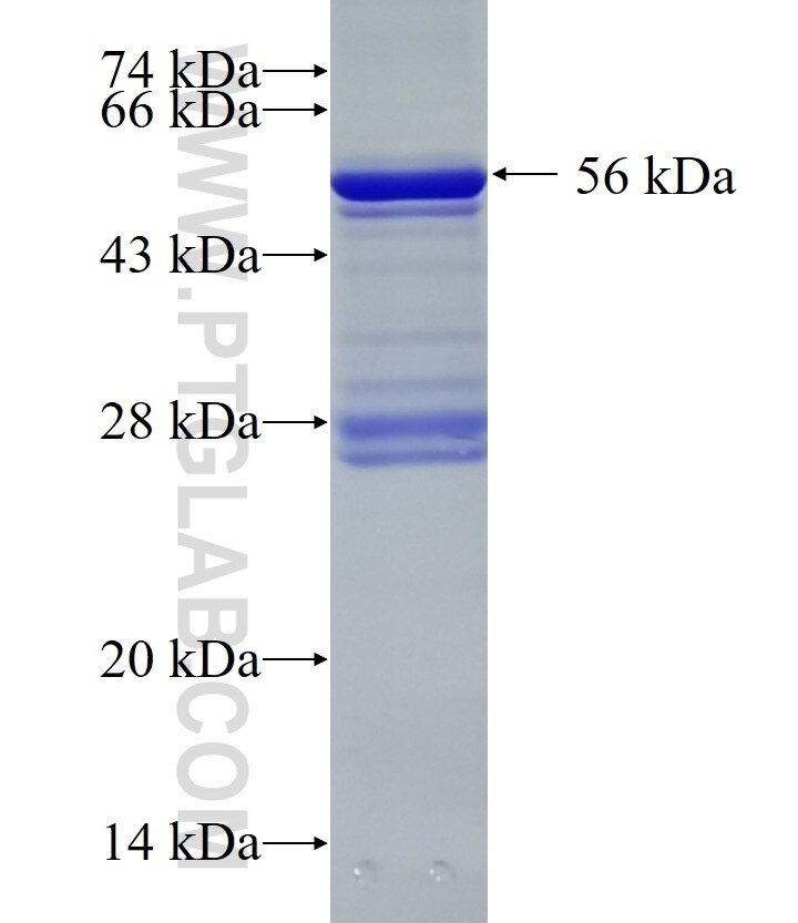 TIRAP fusion protein Ag0771 SDS-PAGE