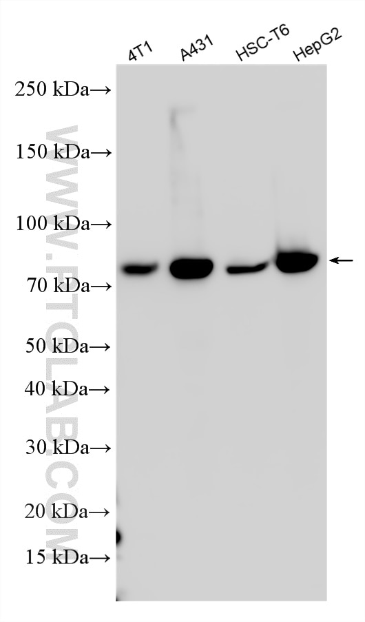 Western Blot (WB) analysis of various lysates using TJAP1 Polyclonal antibody (17734-1-AP)