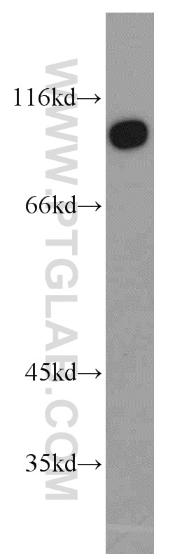 Western Blot (WB) analysis of human skeletal muscle tissue using TJAP1 Polyclonal antibody (17734-1-AP)