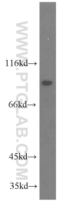 Western Blot (WB) analysis of HepG2 cells using TJAP1 Polyclonal antibody (17734-1-AP)