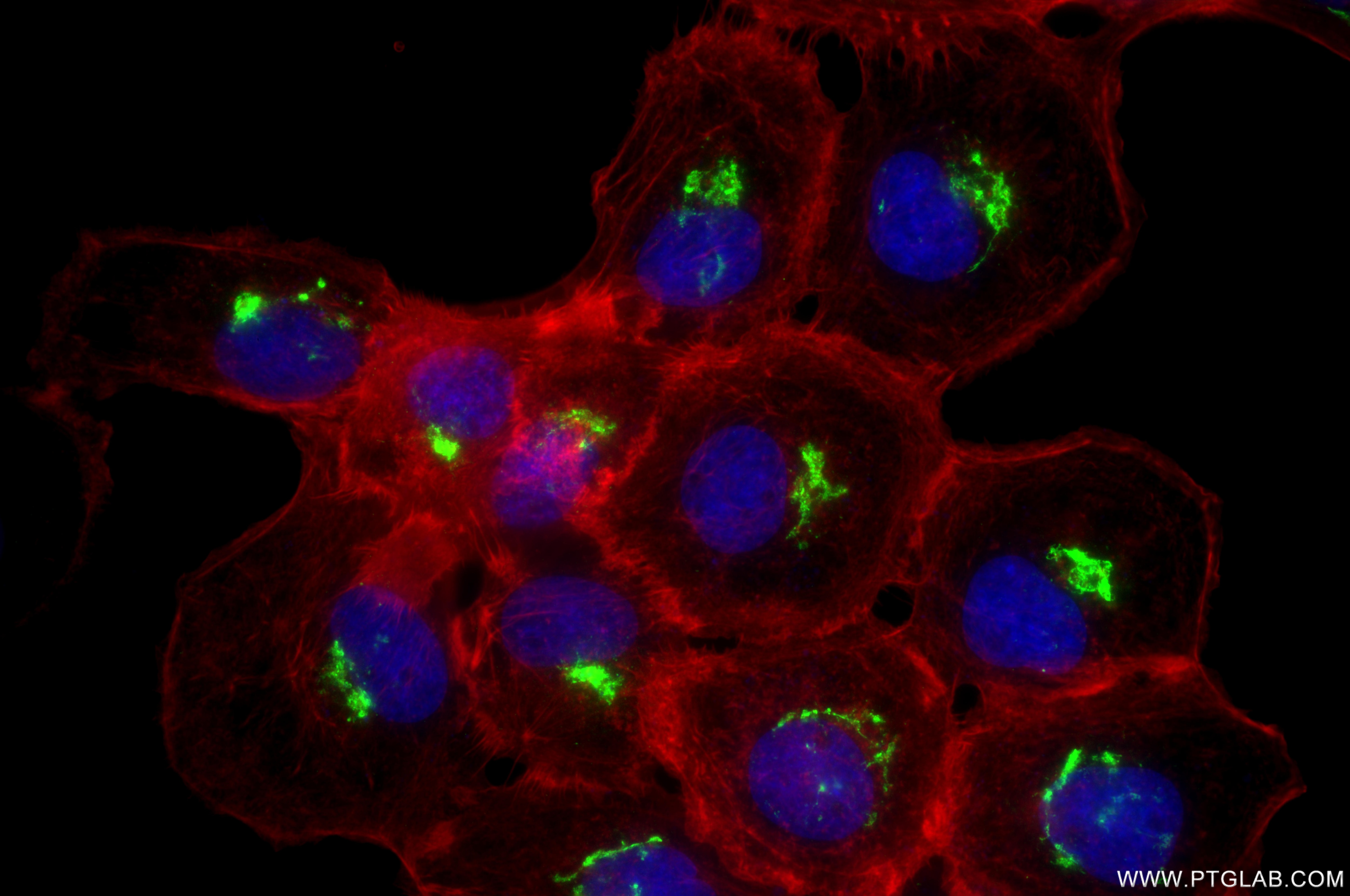 IF Staining of A431 using 87106-3-RR Immunofluorescence (IF) / fluorescent staining of A431 cells using TJAP1 Recombinant monoclonal antibody (87106-3-RR)