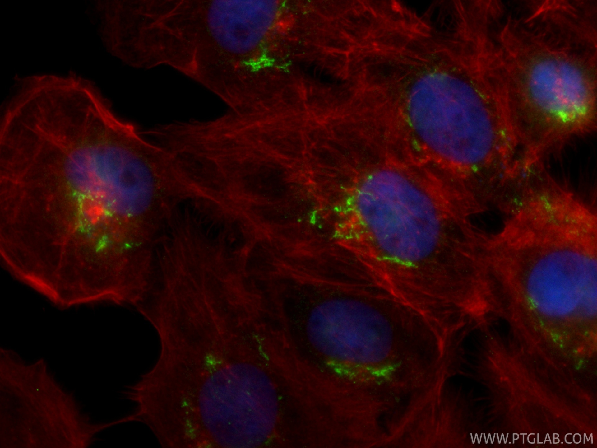 IF Staining of A431 using CL488-87106-3 Immunofluorescence (IF) / fluorescent staining of A431 cells using CoraLite® Plus 488-conjugated TJAP1 Recombinant mo (CL488-87106-3)