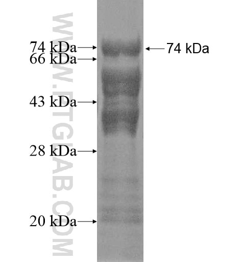 TJAP1 fusion protein Ag12174 SDS-PAGE