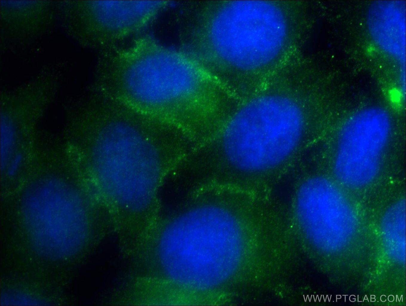 Immunofluorescence (IF) / fluorescent staining of MCF-7 cells using ZO-2 Polyclonal antibody (18900-1-AP)