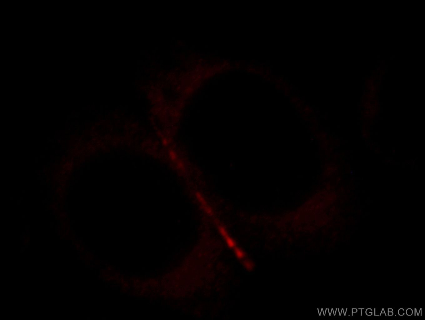 IF Staining of MCF-7 using 18900-1-AP