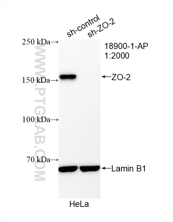 Western Blot (WB) analysis of HeLa cells using ZO-2 Polyclonal antibody (18900-1-AP)