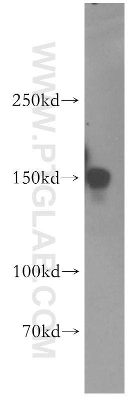 Western Blot (WB) analysis of HeLa cells using ZO-2 Polyclonal antibody (18900-1-AP)