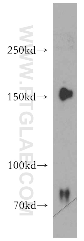 Western Blot (WB) analysis of MCF-7 cells using ZO-2 Polyclonal antibody (18900-1-AP)