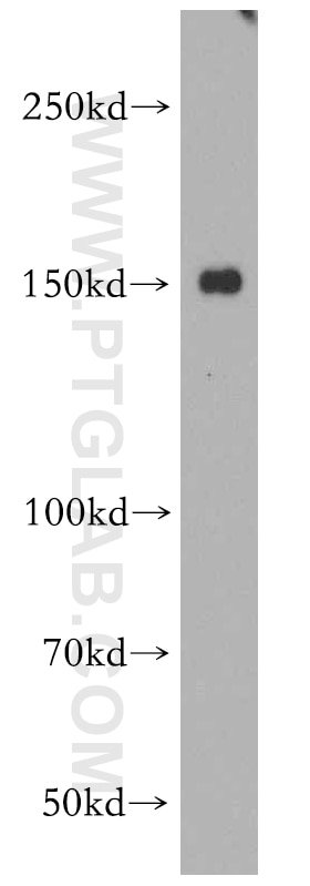 Western Blot (WB) analysis of mouse heart tissue using ZO-2 Polyclonal antibody (18900-1-AP)