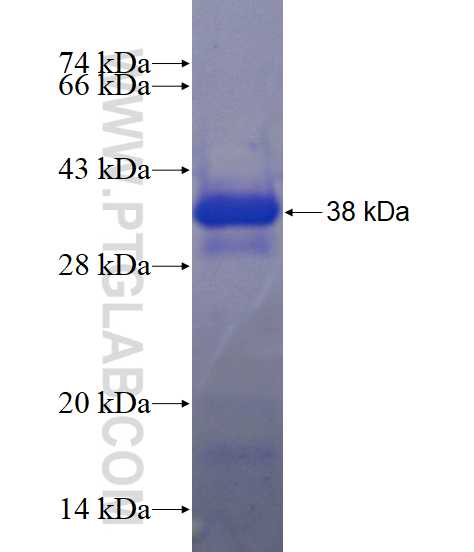 TJP2 fusion protein Ag13577 SDS-PAGE