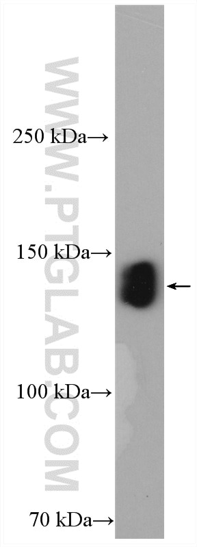 Western Blot (WB) analysis of MCF-7 cells using ZO-3 Polyclonal antibody (22116-1-AP)