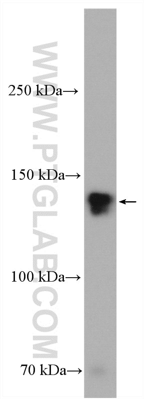 Western Blot (WB) analysis of T-47D cells using ZO-3 Polyclonal antibody (22116-1-AP)