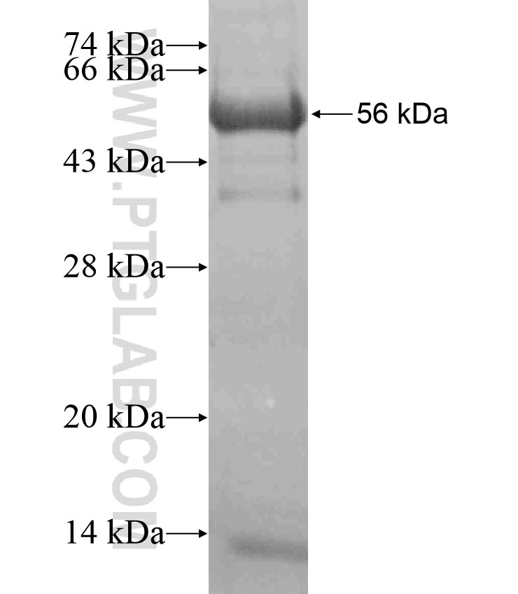 TJP3 fusion protein Ag17495 SDS-PAGE