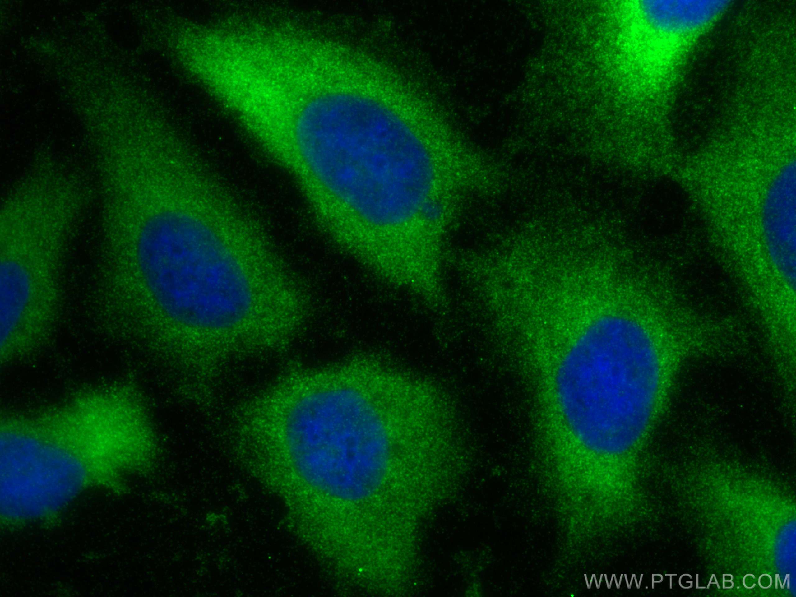 Immunofluorescence (IF) / fluorescent staining of U2OS cells using TK1 Polyclonal antibody (15691-1-AP)