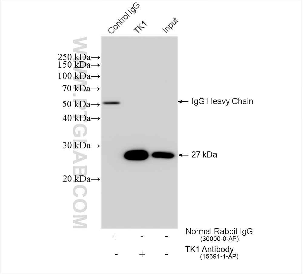 Immunoprecipitation (IP) experiment of HEK-293 cells using TK1 Polyclonal antibody (15691-1-AP)