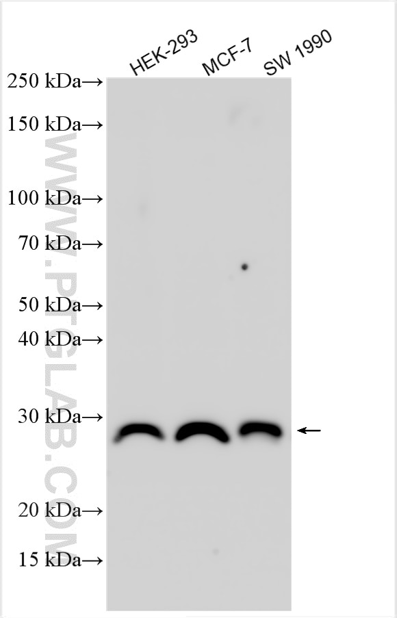Western Blot (WB) analysis of various lysates using TK1 Polyclonal antibody (15691-1-AP)
