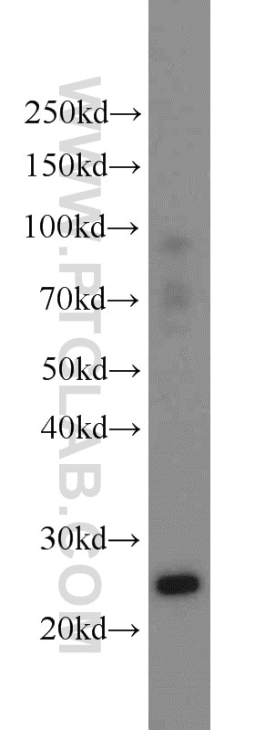 Western Blot (WB) analysis of MCF-7 cells using TK1 Polyclonal antibody (15691-1-AP)