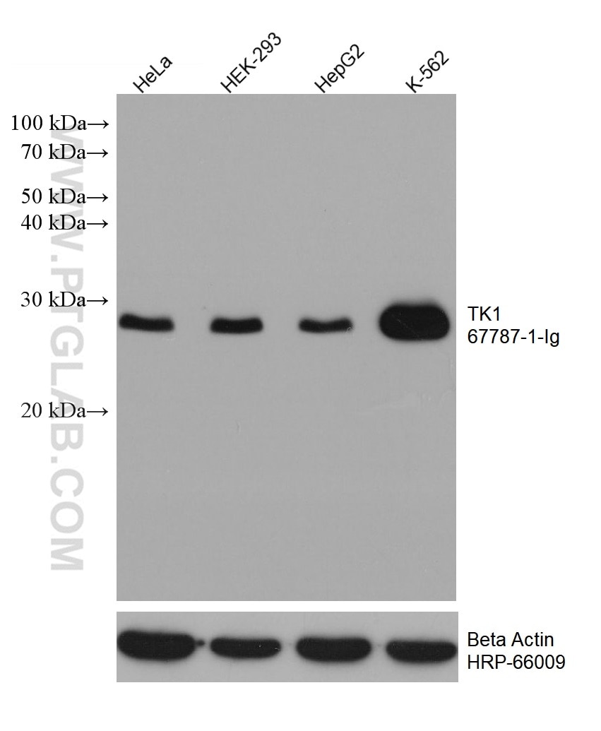 Western Blot (WB) analysis of various lysates using TK1 Monoclonal antibody (67787-1-Ig)