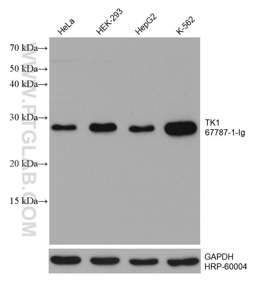 Western Blot (WB) analysis of various lysates using TK1 Monoclonal antibody (67787-1-Ig)