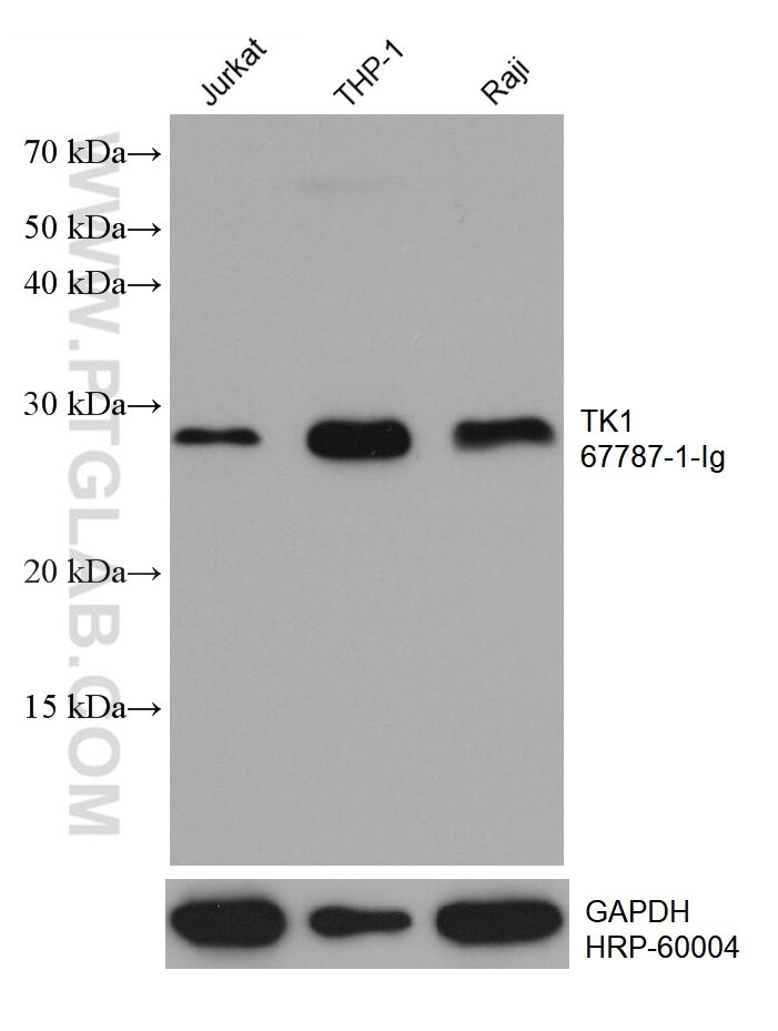 Western Blot (WB) analysis of various lysates using TK1 Monoclonal antibody (67787-1-Ig)