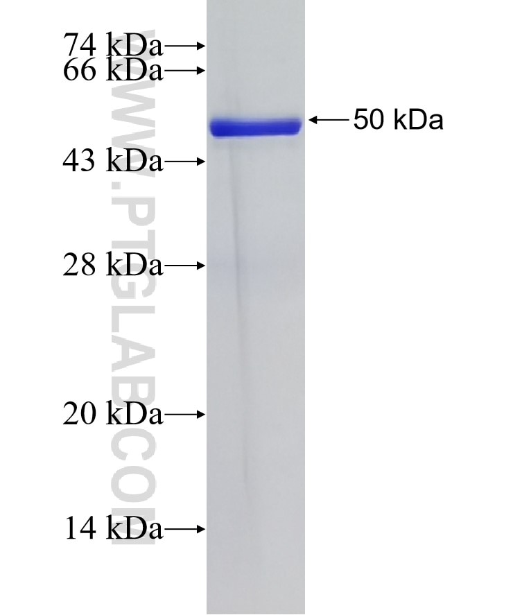 TK1 fusion protein Ag8249 SDS-PAGE