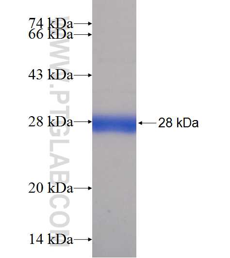 TK1 fusion protein Ag8265 SDS-PAGE