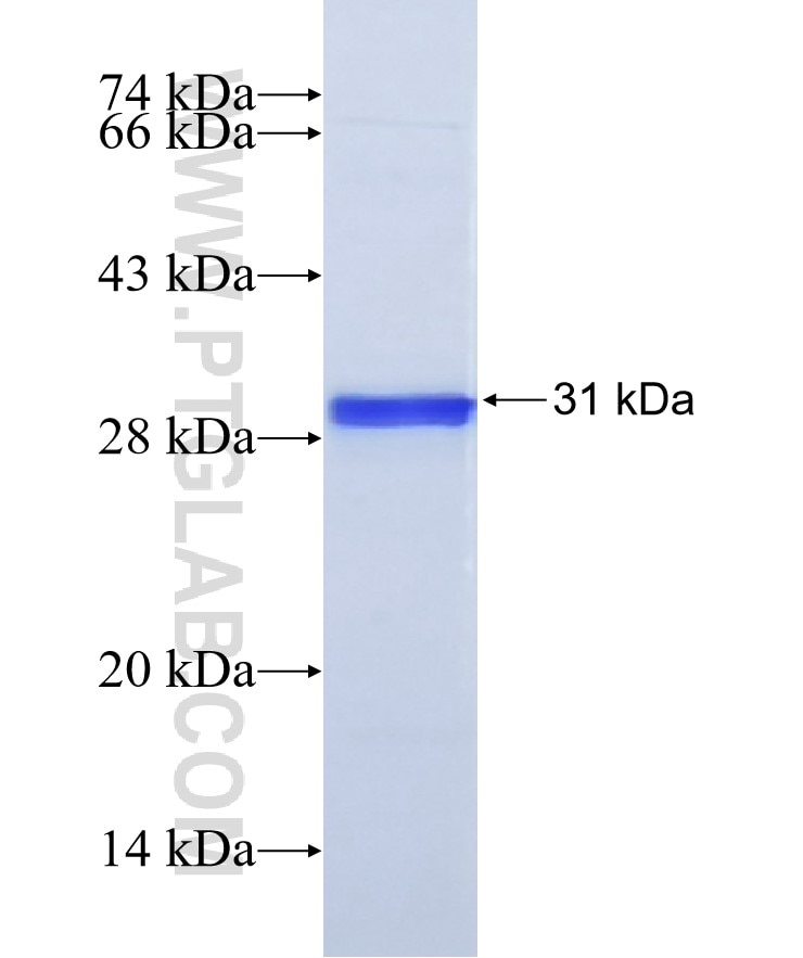 TK1 fusion protein Ag8265 SDS-PAGE