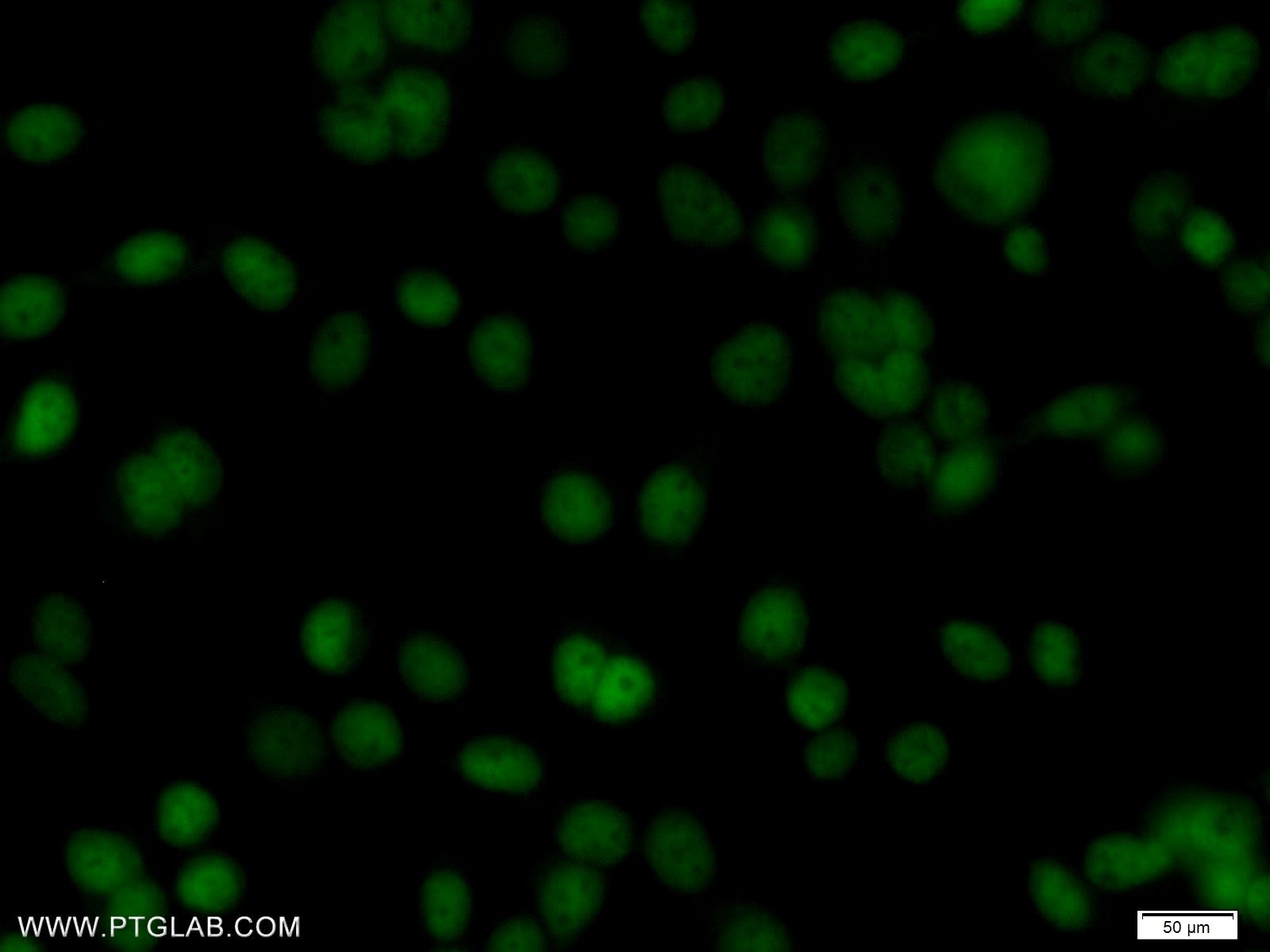 Immunofluorescence (IF) / fluorescent staining of BxPC-3 cells using Transketolase Polyclonal antibody (11039-1-AP)