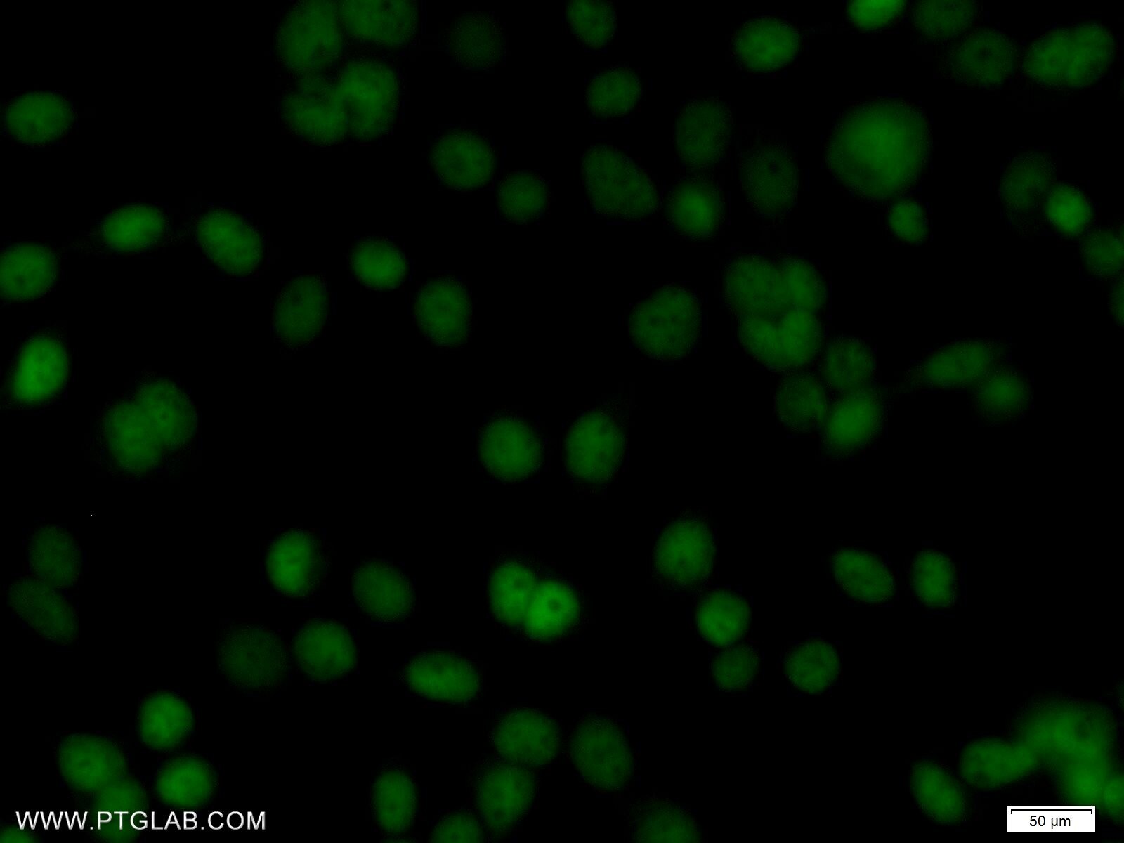 IF Staining of BxPC-3 using 11039-1-AP