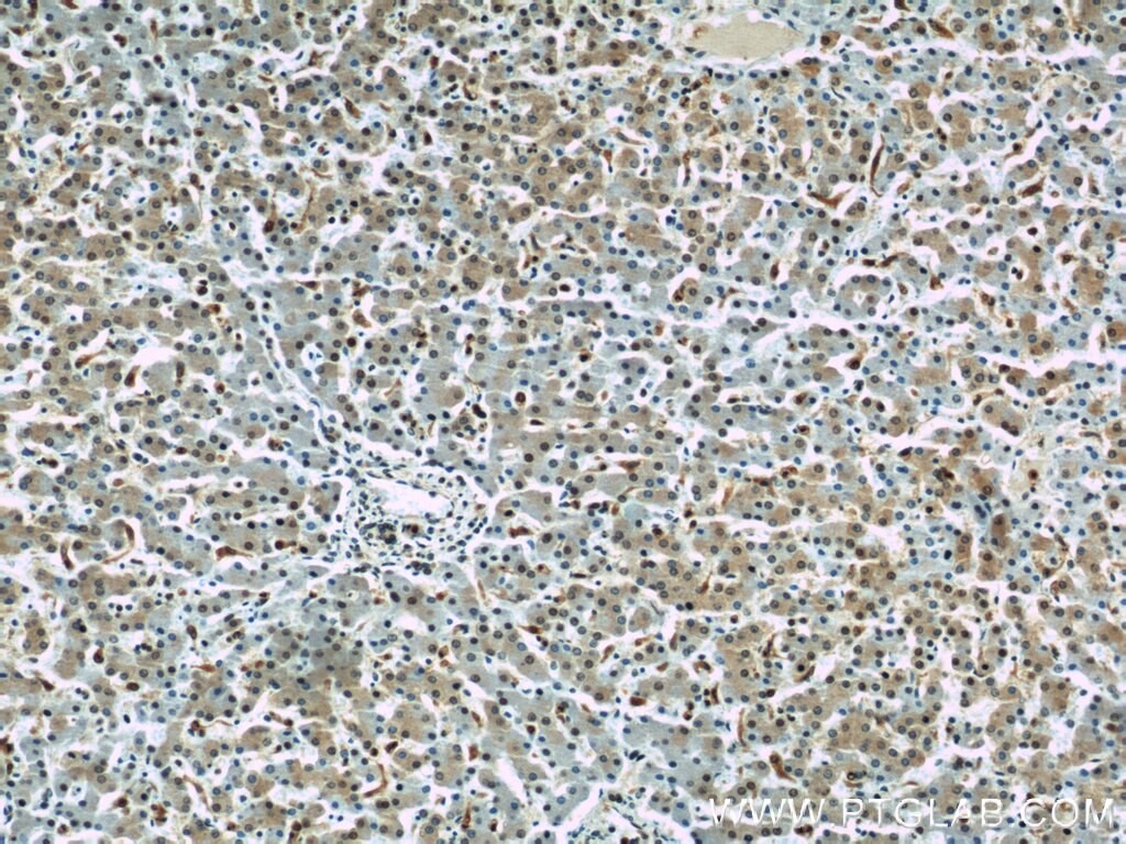 IHC staining of human liver using 11039-1-AP